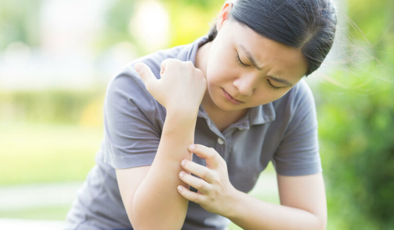 Navigating Autoimmune Diseases